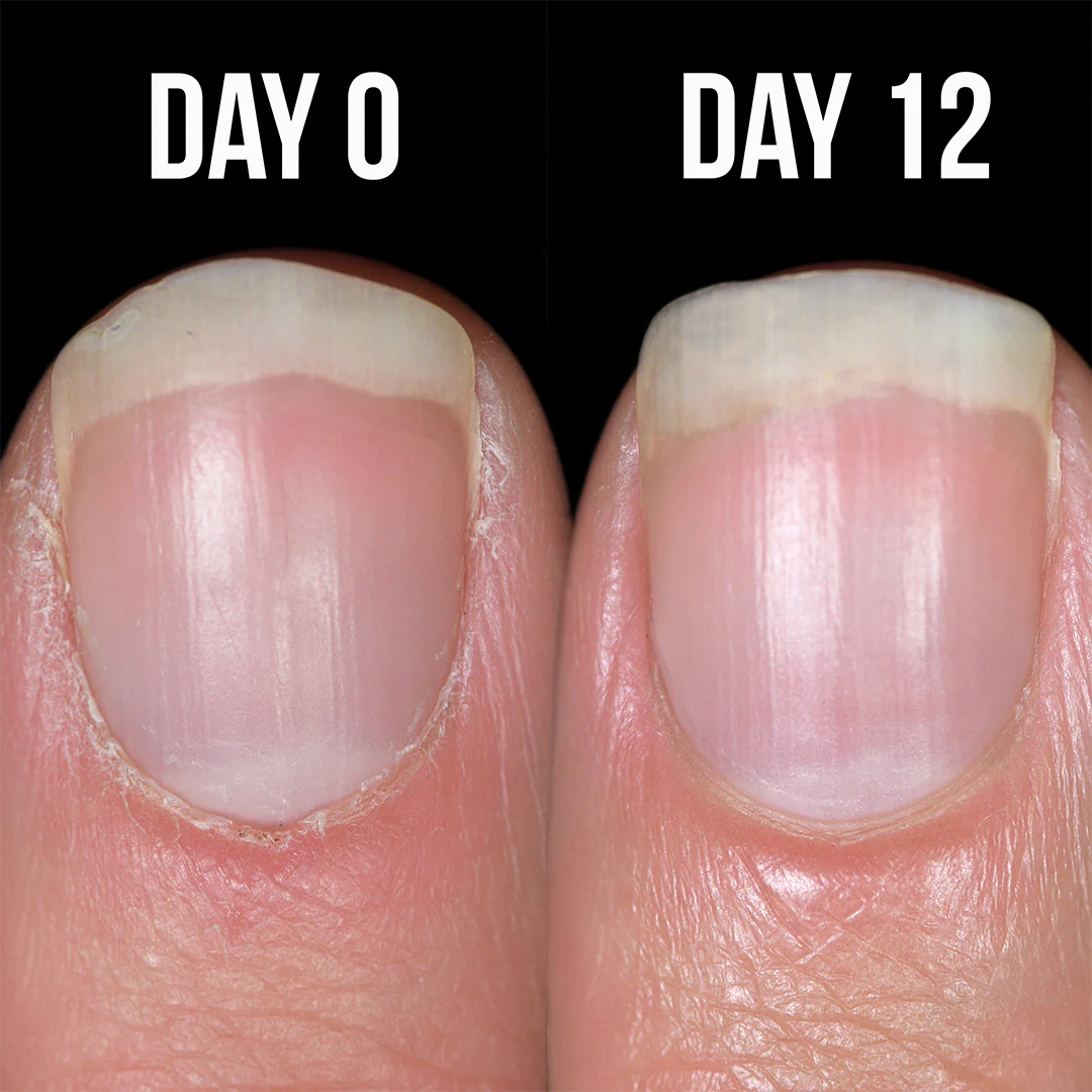 Up Your Nail Game Bundle - Image 9